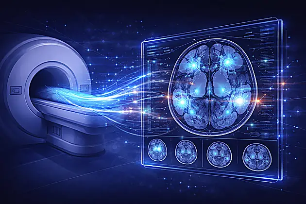 AI Brain MRI Diagnosis: New 2026 Model Reads Scans in Seconds With 97.5 ...