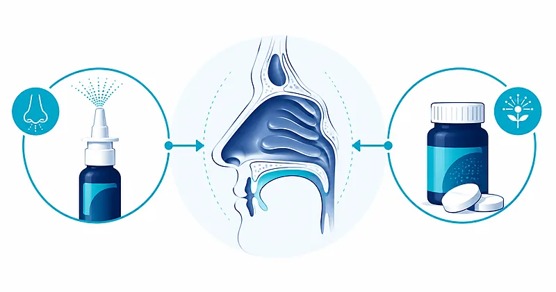Allergic rhinitis treatment comparison: intranasal corticosteroid nasal spray beside oral antihistamine tablets with nasal passage diagram