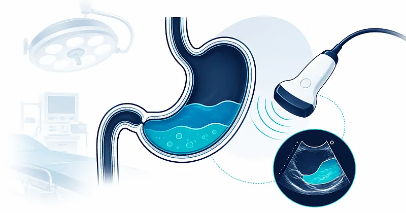 Perioperative GLP-1 agonists illustration showing gastric ultrasound assessment of residual gastric content before surgery