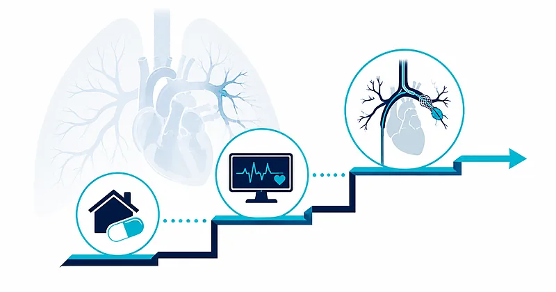 Risk-tiered pulmonary embolism management pathway from home anticoagulation to catheter-directed therapy