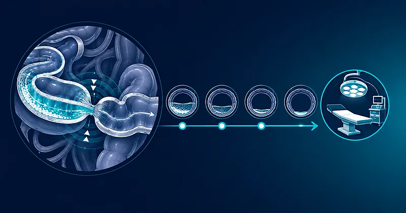Diagram of small bowel obstruction management showing water-soluble contrast transit through the bowel and the surgery-timing decision window