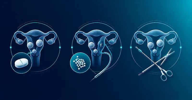 Uterine fibroid treatment options compared: an oral GnRH antagonist tablet, a uterine artery embolization catheter, and surgical instruments.